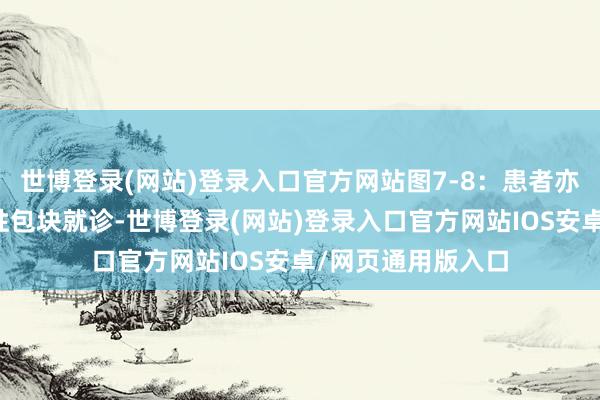 世博登录(网站)登录入口官方网站图7-8：患者亦然因左侧腋下痛性包块就诊-世博登录(网站)登录入口官方网站IOS安卓/网页通用版入口